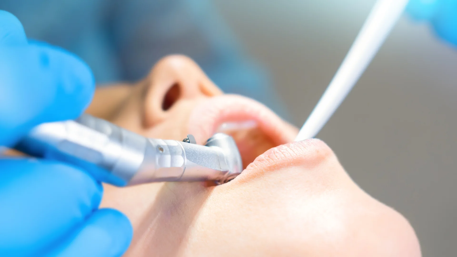 Durerea după extracția dentară: ce este normal și când să te alarmezi