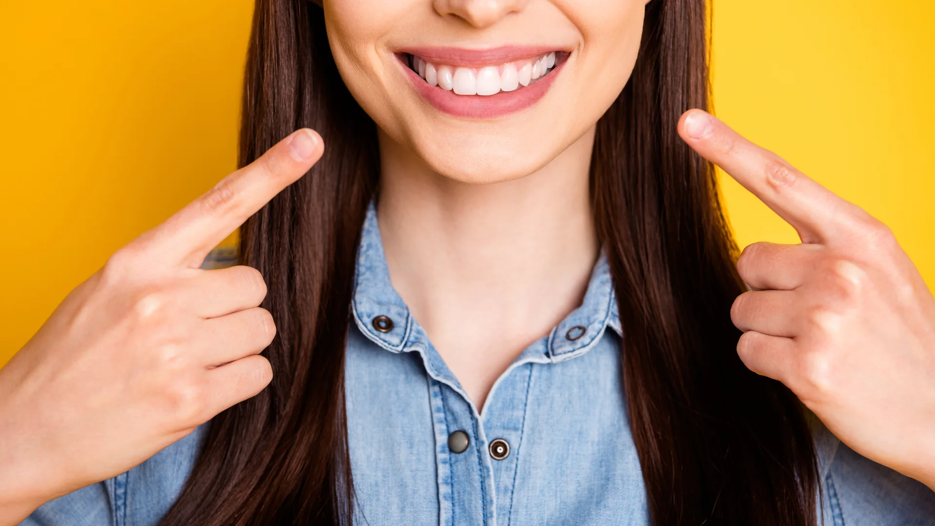 Faccette dentali: quanto costano, quali tipi esistono e a chi si addicono