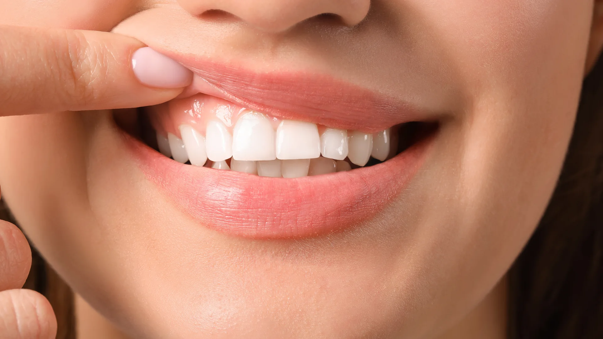 Sângerarea gingiilor: cauze, ce înseamnă și cum o oprești